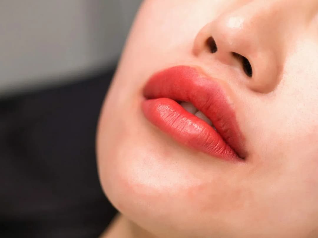 Jak usunąć kwas hialuronowy z ust domowe sposoby - dlaczego to nie działa?