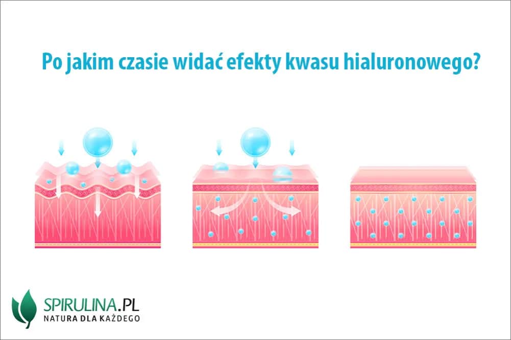 Kwas hialuronowy: kiedy widać efekty i co wpływa na ich trwałość