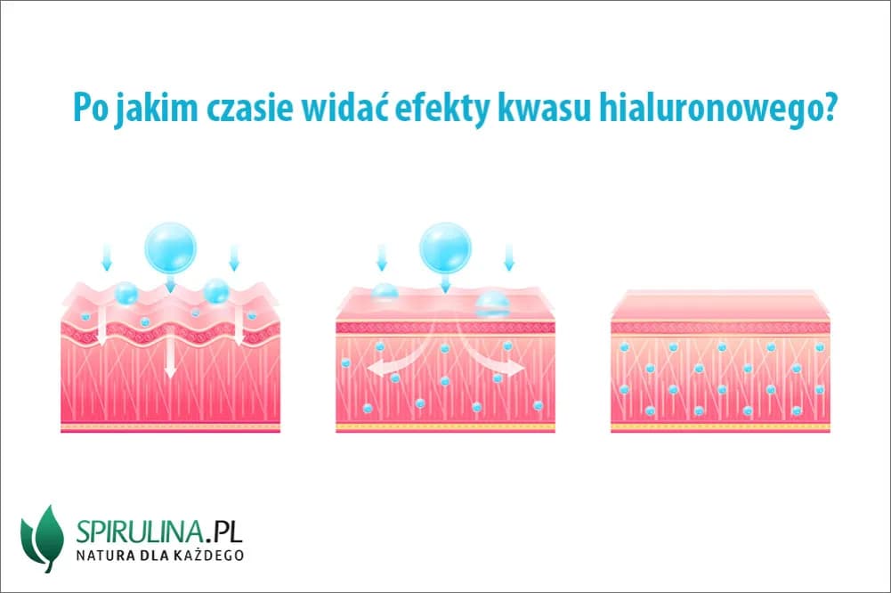 Kwas hialuronowy: kiedy widać efekty i co wpływa na ich trwałość